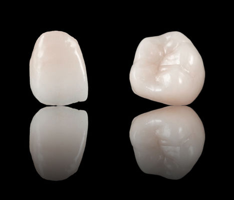 購入 高級エステティクス フルコンター 歯科 クラウン ジルコニア ブリッジ CE&FDA 承認 online manufacture