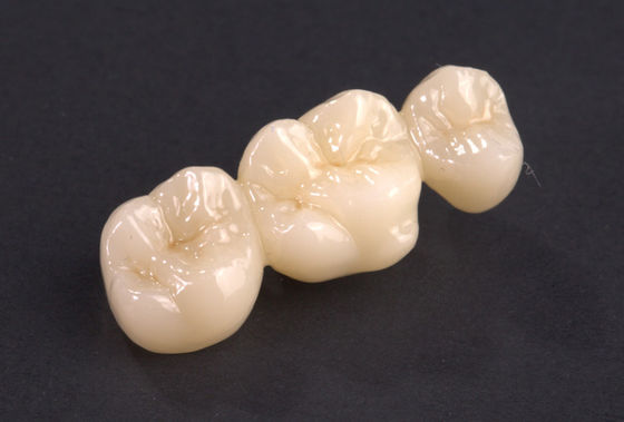 購入 正確なフィット 完全なコンター ジルコニア橋 自然ジルコニア クラウン橋 高強度 online manufacture