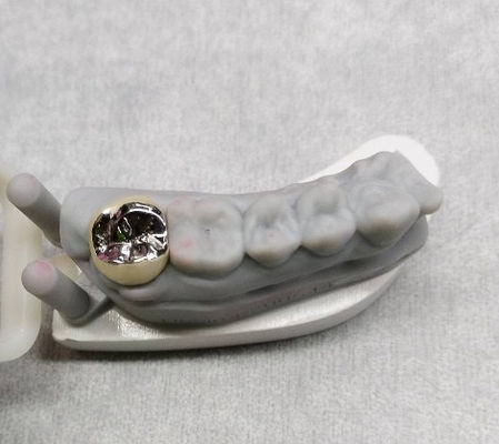 購入 半貴金属合金 冠と橋歯 仮冠 online manufacture