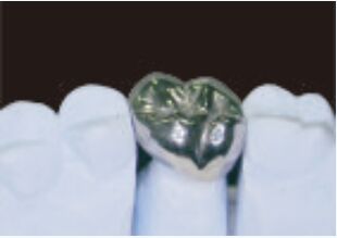 購入 金属のクラウンと橋 高精度銀のクラウン online manufacture