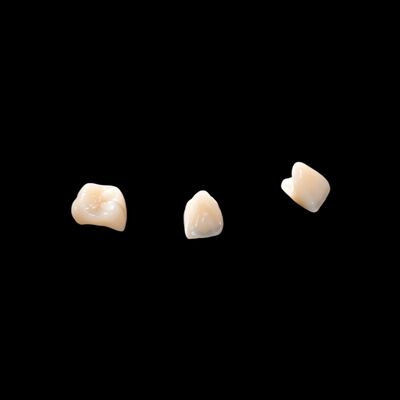 購入 CAD/CAM ポルセラン セルコニア ブリッジ に 溶かさ れ て 自然 な 見方 を 回復 する online manufacture