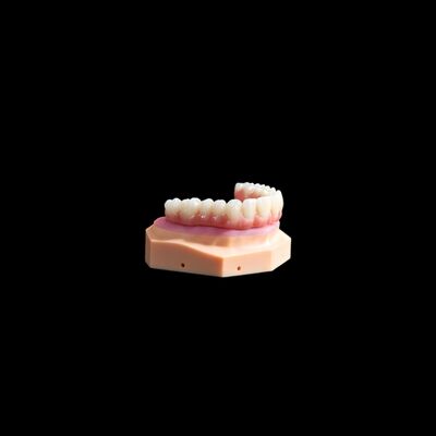 購入 Xインプラントチタンブリッジ 複合精密歯科 online manufacture