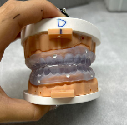 3Dプリントでカスタマイズできる歯科 デジタル完全歯科を試す