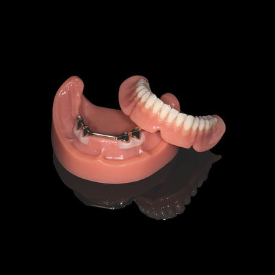 ピンクチタンバー 脱ぎ取れる歯科 アクリル歯科仕上げ